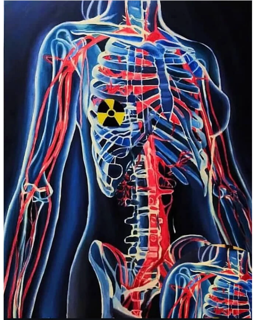 Pranga radioattiva: Anatomia Potante &middot; Aspetto 1